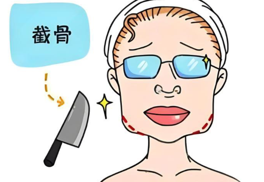 四、磨骨手术注意事项