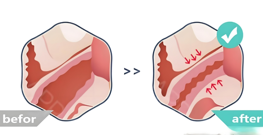 二、郑州圣玛医院私密整形科室